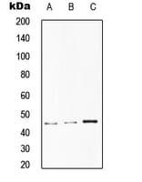 Polyclonal Rabbit anti-Human ST6GAL1 / CD75 Antibody (Internal, IHC, WB)