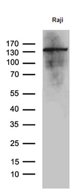 IFIH1 / MDA5 Antibody (clone OTI1C7)
