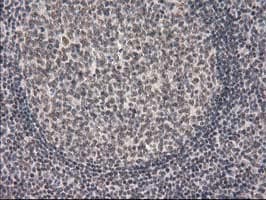 PRKCE / PKC-Epsilon Antibody (clone OTI4G8)