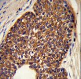 Polyclonal Rabbit anti-Human MTBP / Mdm2-Binding Protein Antibody (aa853-881, IHC, WB)