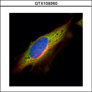 EPHX1 / Epoxide Hydrolase 1 Antibody (aa1-223)