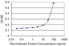 IHC-plus™ SEPT6 / Septin 6 Antibody (clone 1D6)