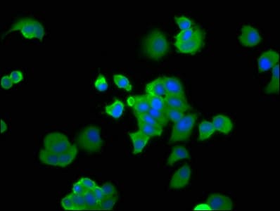 Polyclonal Rabbit anti-Human PA2G4 / EBP1 Antibody (IHC, WB)