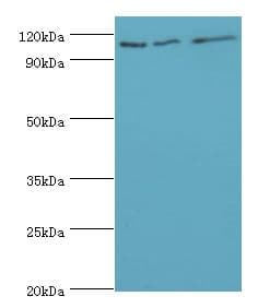 IHC-plus™ Polyclonal Rabbit anti-Human MER / MERTK Antibody (aa840-999, IHC, WB)