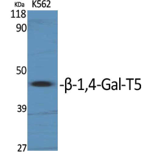 Polyclonal Rabbit anti-Human B4GALT5 Antibody (290-370 aa, C-terminal, WB)