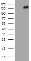 Monoclonal Mouse anti-Human Hamartin / TSC1 Antibody (clone OTI2B2, WB)
