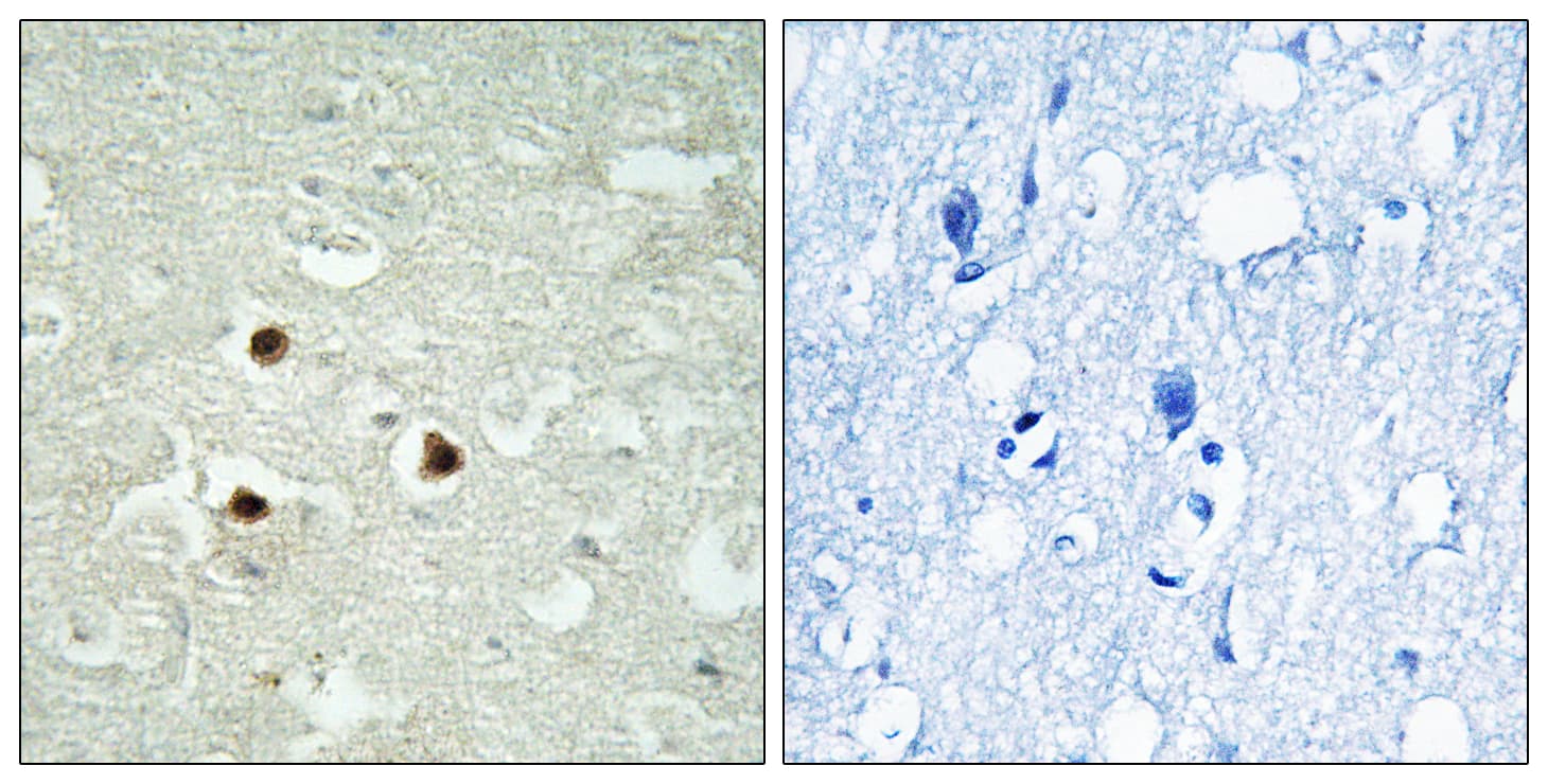 Polyclonal Rabbit anti-Human RAB3IP / RABIN3 Antibody (aa257-306, IHC)