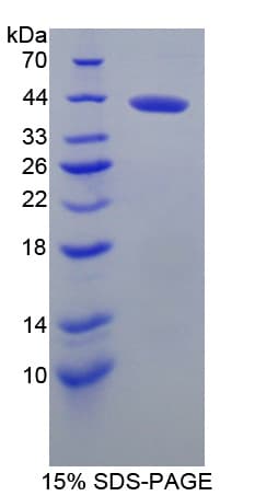 Mouse BCAN / Brevican Protein (Recombinant His-T7)