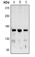RAB3GAP2 / p150 Antibody