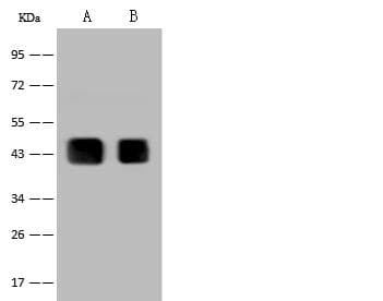 Polyclonal Rabbit anti-Human PAX2 Antibody (Preservative Free, IHC, IF, WB)