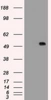 SERPINA1 / Alpha 1 Antitrypsin Antibody (clone 11G2, Carrier-free)