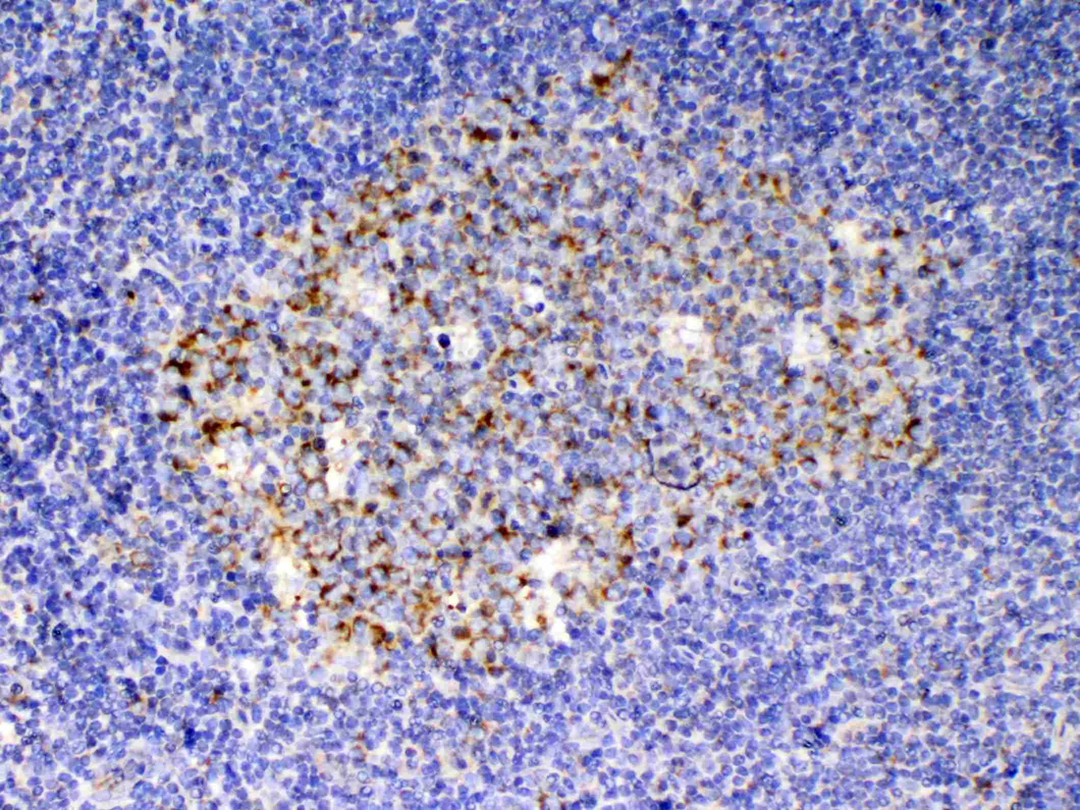 Polyclonal Rabbit anti-Human KITLG / SCF Antibody (IHC, WB)