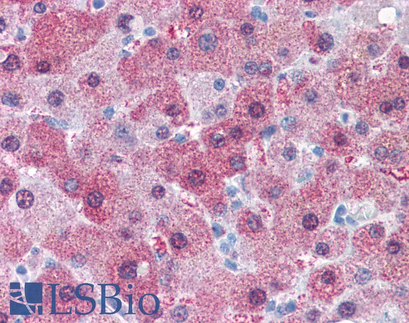 IHC-plus™ GCNT3 Antibody (Internal)
