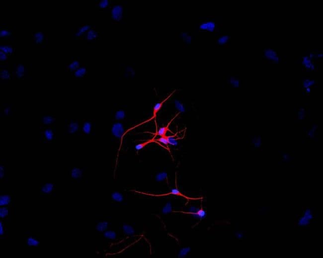 Monoclonal Mouse anti-Human TUBB3 / Tubulin Beta 3 Antibody (clone TU-20, FITC, Amino Acid: 441-448)