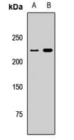 TRIP12 Antibody