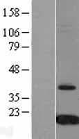TTR / Transthyretin Protein (Over-Expression Lysate Myc-DDK (Flag))