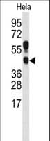 IHC-plus™ PRMT1 Antibody (aa317-346)