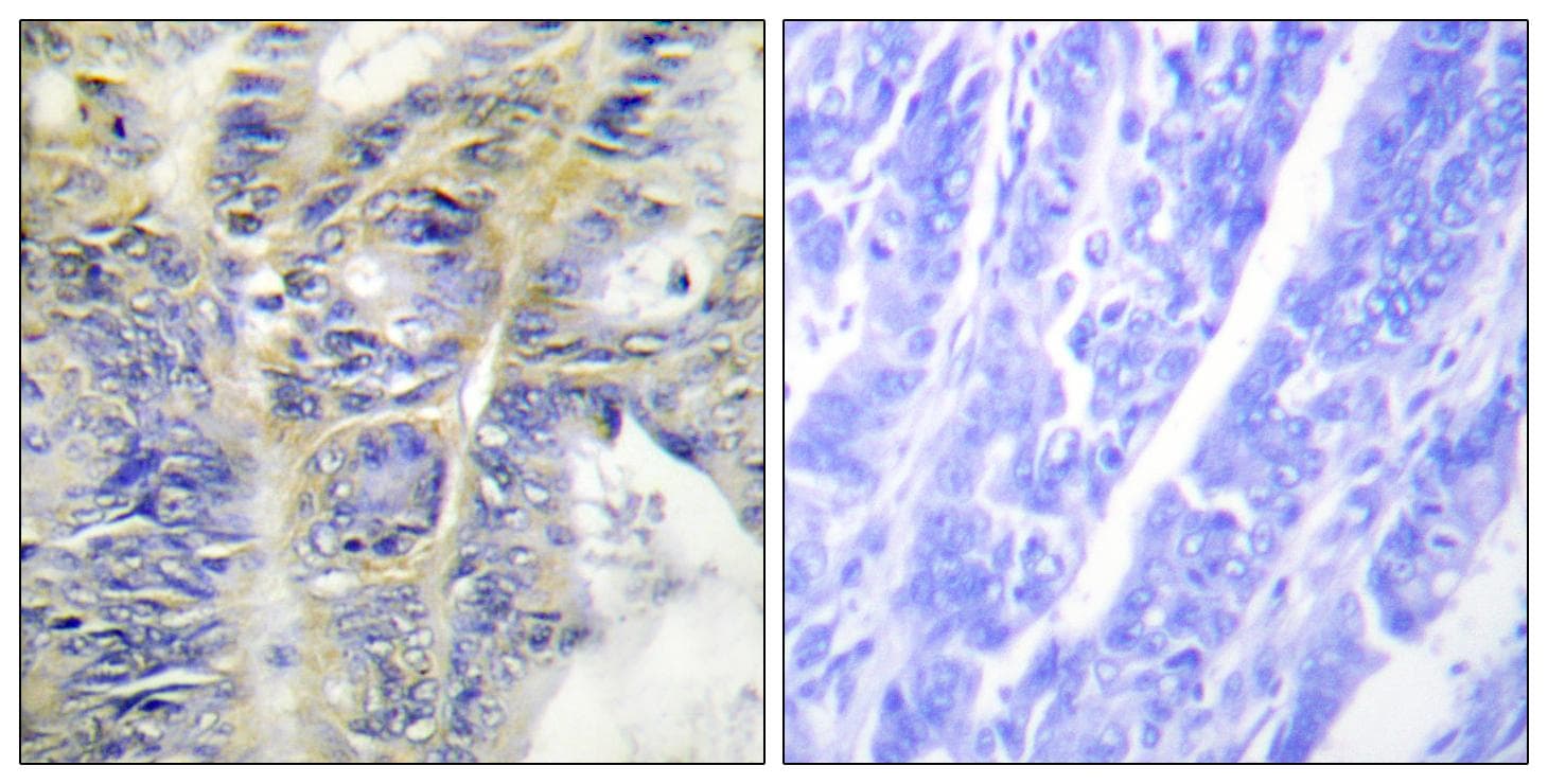 COL4A5 / Collagen IV Alpha5 Antibody
