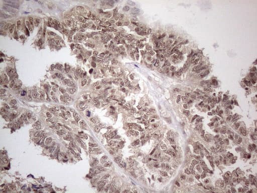 MED15 / ARC105 Antibody (aa393-679, clone OTI2C6)