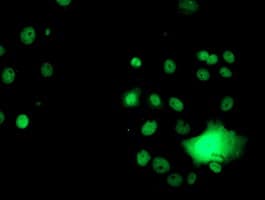 GSTT2 Antibody (clone OTI3B6)