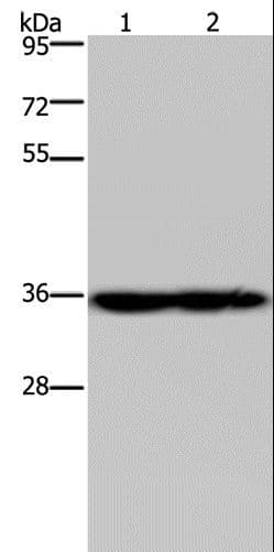 NDUFA9 Antibody