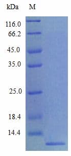 Mouse CCL8 / MCP2 Protein (Recombinant)