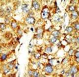 Polyclonal Rabbit anti-Human SETD8 / SET8 Antibody (aa25-53, IHC, WB)