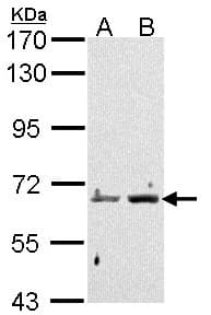 PADI4 / PAD4 Antibody (aa326-611)