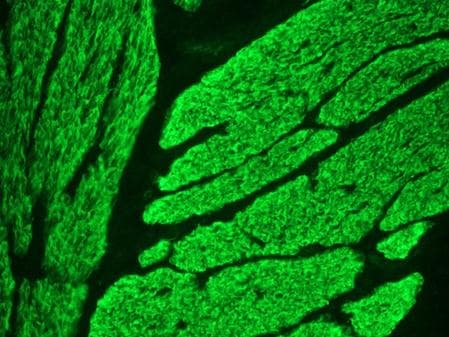 PathPlus™ Smoothelin Antibody (clone R4A)