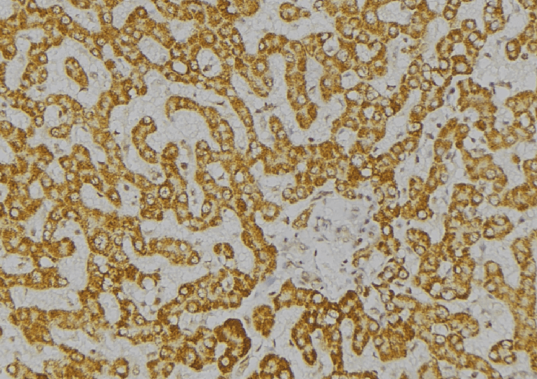 ITPA Antibody