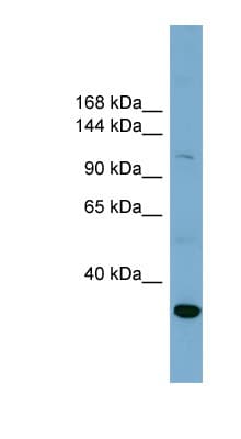 SLC9A1 / NHE1 Antibody (C-Terminus)