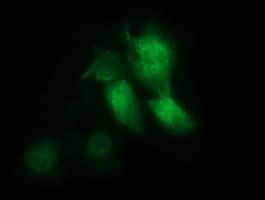 MSI1 / Musashi 1 Antibody (clone OTI2B2)