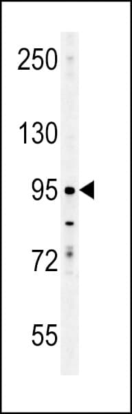 ENAM Antibody (aa1097-1126)