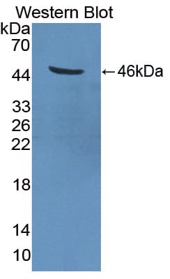 TMPRSS4 Antibody (aa54-437, PE)