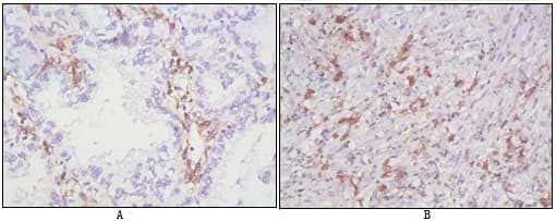 Monoclonal Mouse anti-Human CD38 Antibody (clone 6E12D, IHC, WB)