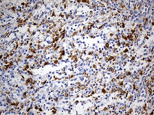 Monoclonal Mouse anti-Human CD68 Antibody (clone OTI2E2, aa22-319, IHC, WB)