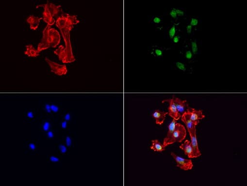 VBP1 Antibody (clone UMAB75)