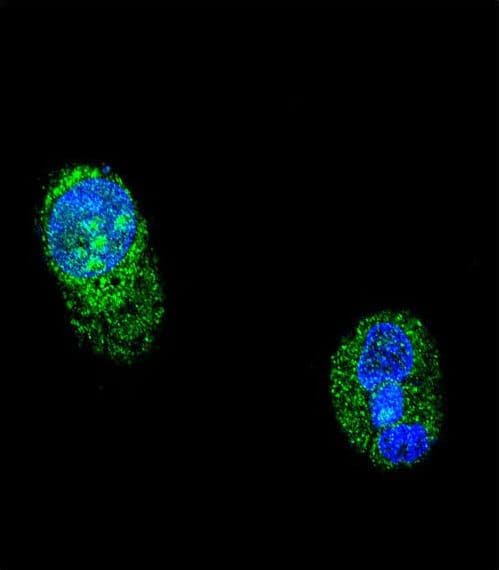 HNF1A / HNF1 Antibody (aa177-205)