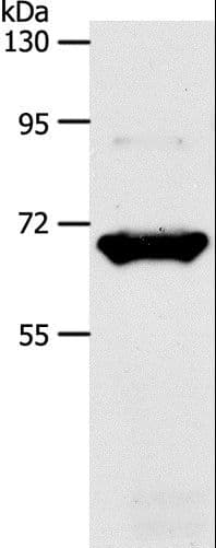 Polyclonal Rabbit anti-Human SLC33A1 Antibody (WB)