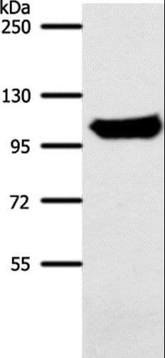 ACO1 / Aconitase Antibody