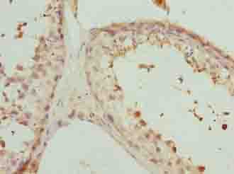 PHF13 Antibody