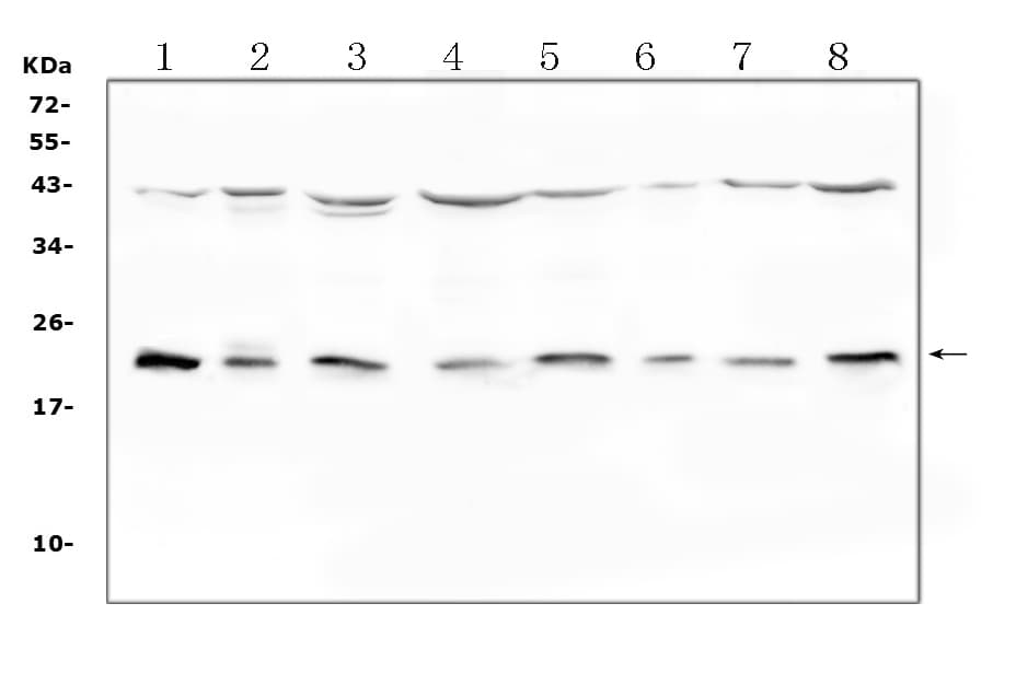 Polyclonal Rabbit anti-Human IL1RN Antibody (WB)