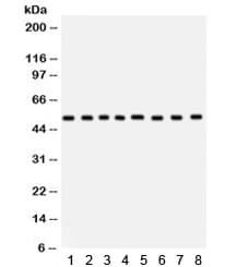 WAS / WASP Antibody