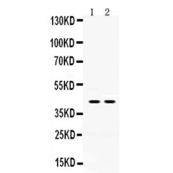 Polyclonal Rabbit anti-Human HSD2 / HSD11B2 Antibody (aa277-309, IHC, WB)