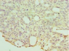 Polyclonal Rabbit anti-Human HYAL1 Antibody (aa136-435, IHC, WB)