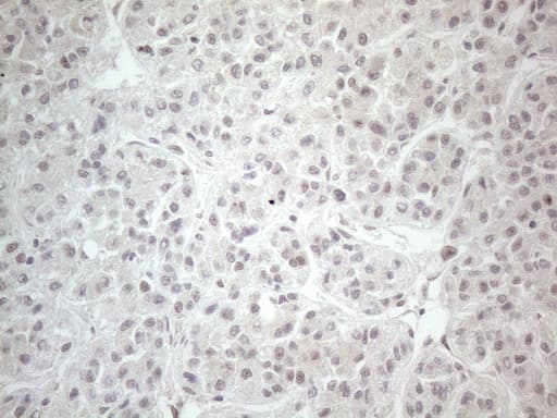 CTBP2 Antibody (aa233-336, clone OTI4D4)
