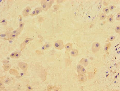 TGFBR2 Antibody
