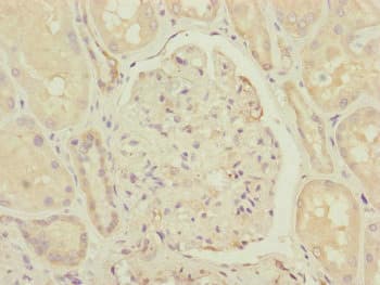 CCHCR1 Antibody