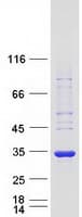 Human KCTD4 Protein (Recombinant Myc-DDK (Flag))