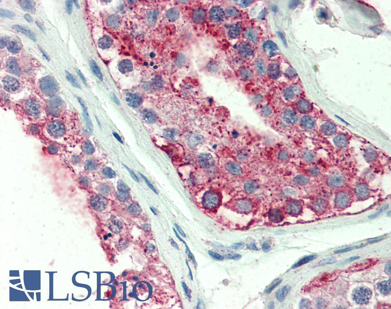 IHC-plus™ Polyclonal Rabbit anti-Human GPCRW / GPR18 Antibody (Extracellular Domain, IHC)